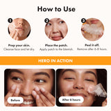 Hero Cosmetics Mighty Patch Nose – Hydrocolloid Nose Strips for Pores & Pimples, Absorbs Gunk and Oil, Improves the Look of Pores , 10 Count