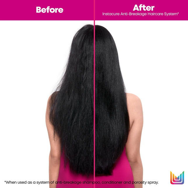 Matrix Instacure Anti-Breakage Conditioner, Repairs, Strengthens & Nourishes Hair, Reduces & Prevents Breakage & Frizz, For Dry, Damaged & Brittle Hair, 300ml