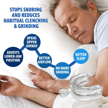 MIRORA Unisex Effective Snoring Solution & Reusable Snore Guard Anti-Snoring Mouthpiece