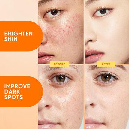 MOOYAM Vitamin C Serum for Face, Niacinamide Serum & Carotene, Improve Appearance of Dark Spots, Tone, For All Skin Types, 30ml