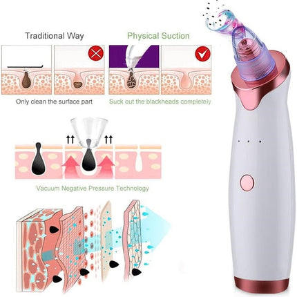 Blackhead Remover Pore Vacuum Extractor Pore Cleaner Electronic Comedone Remover