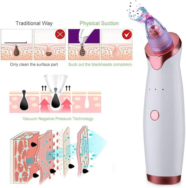 Blackhead Remover Pore Vacuum Extractor Pore Cleaner Electronic Comedone Remover